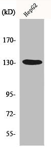Western Blot analysis of HepG2 cells using HDAC6 Polyclonal Antibody