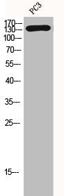 Western Blot analysis of PC-3 cells using HDAC7 Polyclonal Antibody