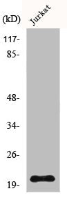 Western Blot analysis of Jurkat cells using HEN1/2 Polyclonal Antibody
