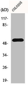 Western Blot analysis of COLO205 cells using HisRS Polyclonal Antibody