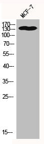 Western Blot analysis of MCF7 cells using Histone deacetylase 6 Polyclonal Antibody