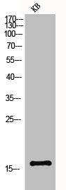 Western Blot analysis of KB cells using Histone H3 Polyclonal Antibody