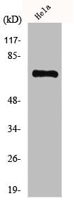 Western Blot analysis of COLO205 cells using HKR1 Polyclonal Antibody