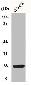 Western Blot analysis of COLO205 cells using HMG-2 Polyclonal Antibody