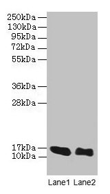 Western blot All lanes: LINC01553 antibody at 12µg/ml Lane 1: Rat heart tissue Lane 2: Mouse skeletal muscle tissue Secondary Goat polyclonal to rabbit IgG at 1/10000 dilution Predicted band size: 16 kDa Observed band size: 16 kDa