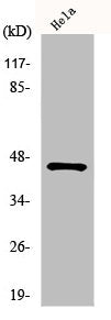 Western Blot analysis of COLO205 cells using HORMAD1 Polyclonal Antibody