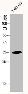 Western Blot analysis of 293T-UV cells using HoxA11/D11 Polyclonal Antibody