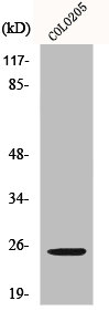 Western Blot analysis of Jurkat cells using Hox-A7 Polyclonal Antibody