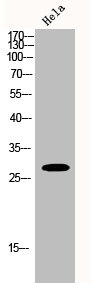 Western Blot analysis of Hela cells using Hox-B9 Polyclonal Antibody