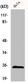 Western Blot analysis of A549 cells using HP1α Polyclonal Antibody
