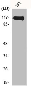 Western Blot analysis of Jurkat cells using Hrs Polyclonal Antibody