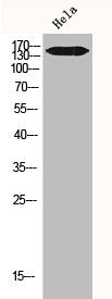 Western Blot analysis of Hela cells using IGF-IR Polyclonal Antibody