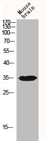 Western Blot analysis of MOUSE-BRAIN cells using IGFBP3 Polyclonal Antibody