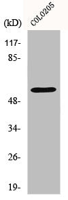 Western Blot analysis of COLO205 cells using Ikaros 3 Polyclonal Antibody