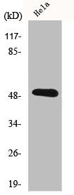 Western Blot analysis of HeLa cells using IL-11Rα Polyclonal Antibody