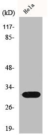 Western Blot analysis of HeLa cells using IL-1β Polyclonal Antibody