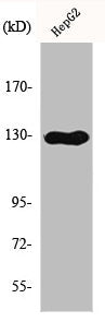 Western Blot analysis of HepG2 cells using IL-3Rβ Polyclonal Antibody