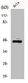 Western Blot analysis of HeLa cells using ILKAP Polyclonal Antibody