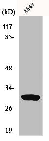 Western Blot analysis of A549 cells using Inhibin β-C Polyclonal Antibody