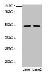 Western blot All lanes: DDX39B antibody at 2µg/ml Lane 1: EC109 whole cell lysate Lane 2: 293T whole cell lysate Secondary Goat polyclonal to rabbit IgG at 1/15000 dilution Predicted band size: 49, 51 kDa Observed band size: 49 kDa