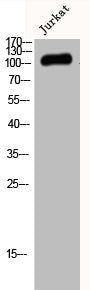 Western Blot analysis of Jurkat cells using JIK Polyclonal Antibody