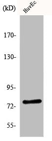 Western Blot analysis of HuvEc cells using KALIG-1 Polyclonal Antibody