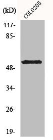 Western Blot analysis of COLO205 cells using KCNG2 Polyclonal Antibody