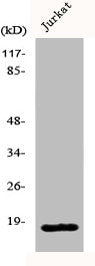 Western Blot analysis of COLO205 cells using KEPI Polyclonal Antibody