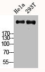 Western Blot analysis of HELA 293T cells using Ki-67 Polyclonal Antibody