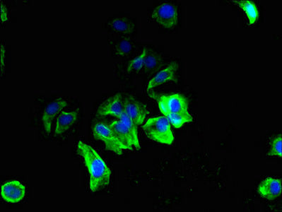 Immunofluorescent analysis of MCF-7 cells using CSB-PA003101LA01HU at dilution of 1:100 and Alexa Fluor 488-congugated AffiniPure Goat Anti-Rabbit IgG(H+L)