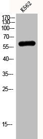 Western Blot analysis of K562 cells using KV3.1 Polyclonal Antibody