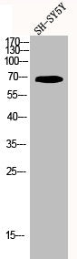 Western Blot analysis of SH-SY5Y cells using Kv3.4 Polyclonal Antibody