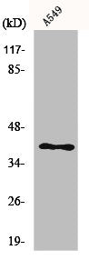 Western Blot analysis of A549 cells using LAT Polyclonal Antibody