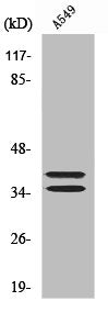 Western Blot analysis of Jurkat cells using LAT Polyclonal Antibody