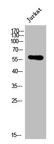 Western Blot analysis of Jurkat cells using Lck Polyclonal Antibody