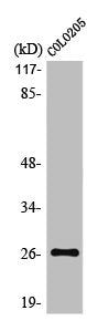 Western Blot analysis of COLO205 cells using LDOC1L Polyclonal Antibody