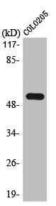 Western Blot analysis of COLO205 cells using LPD lipase Polyclonal Antibody