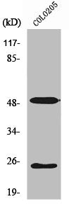Western Blot analysis of COLO205 cells using LRAT Polyclonal Antibody