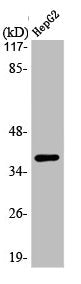Western Blot analysis of HepG2 cells using L-type Ca++ CP γ7 Polyclonal Antibody