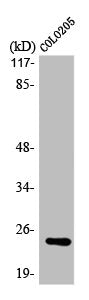Western Blot analysis of COLO205 cells using LYPLA1 Polyclonal Antibody