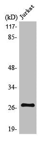 Western Blot analysis of HepG2 cells using MaxiKβ2 Polyclonal Antibody
