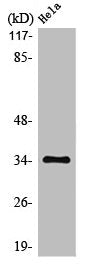 Western Blot analysis of HeLa cells using MC2-R Polyclonal Antibody