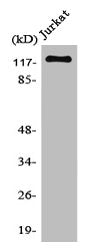 Western Blot analysis of Jurkat cells using MDA5 Polyclonal Antibody