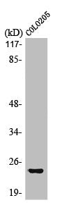 Western Blot analysis of Jurkat cells using Med18 Polyclonal Antibody