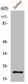 Western Blot analysis of Jurkat cells using MGMT Polyclonal Antibody