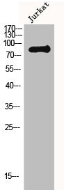 Western Blot analysis of Jurkat cells using MLH1 Polyclonal Antibody