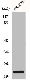 Western Blot analysis of COLO205 cells using ML-IAP Polyclonal Antibody