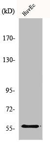 Western Blot analysis of HuvEc cells using MMP-19 Polyclonal Antibody