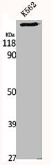 Western Blot analysis of K562 cells using MRCKα Polyclonal Antibody
