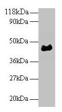 Western blot All lanes: α1-acidglycoprotein antibody at 2µg/ml + Human serum at 1: 50 Secondary Goat polyclonal to rabbit IgG at 1/10000 dilution Predicted band size: 45 kDa Observed band size: 45 kDa